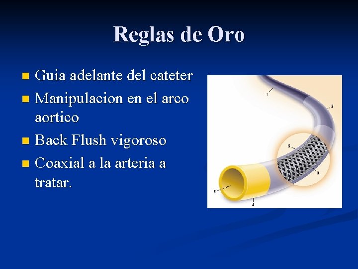 Reglas de Oro Guia adelante del cateter n Manipulacion en el arco aortico n