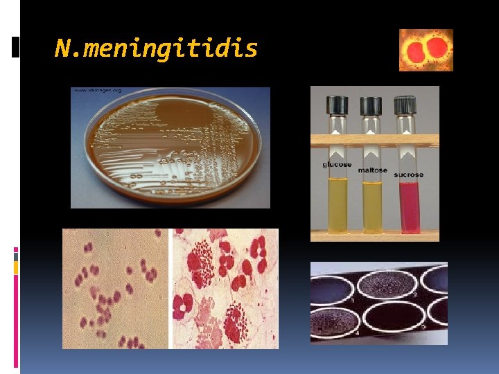 N. meningitidis 