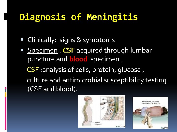 Diagnosis of Meningitis Clinically: signs & symptoms Specimen : CSF acquired through lumbar puncture