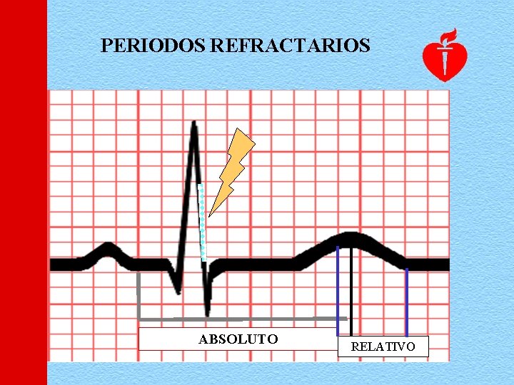 PERIODOS REFRACTARIOS ABSOLUTO RELATIVO 