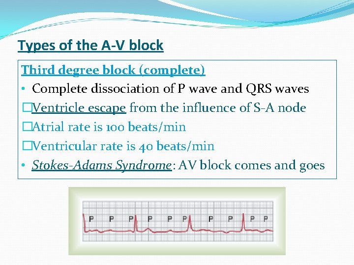 Cardiovascular System Block Cardiac Arrhythmias Physiology Lecture
