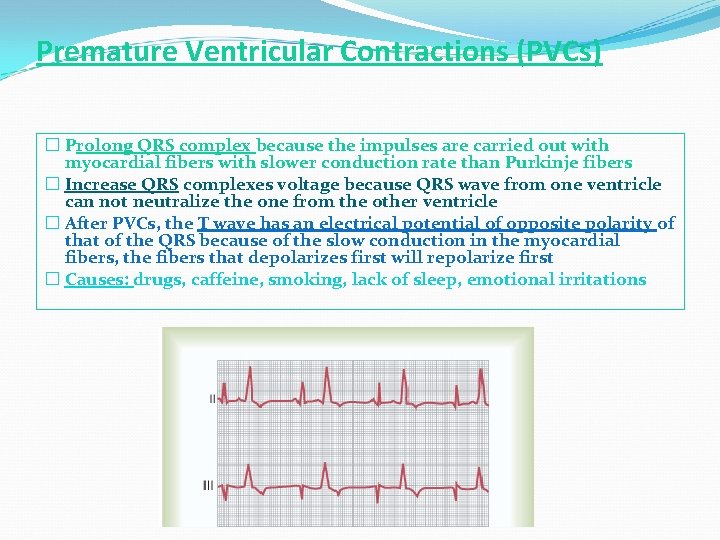 Premature Ventricular Contractions (PVCs) � Prolong QRS complex because the impulses are carried out