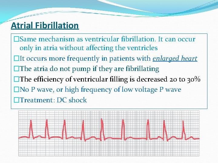 Atrial Fibrillation �Same mechanism as ventricular fibrillation. It can occur only in atria without