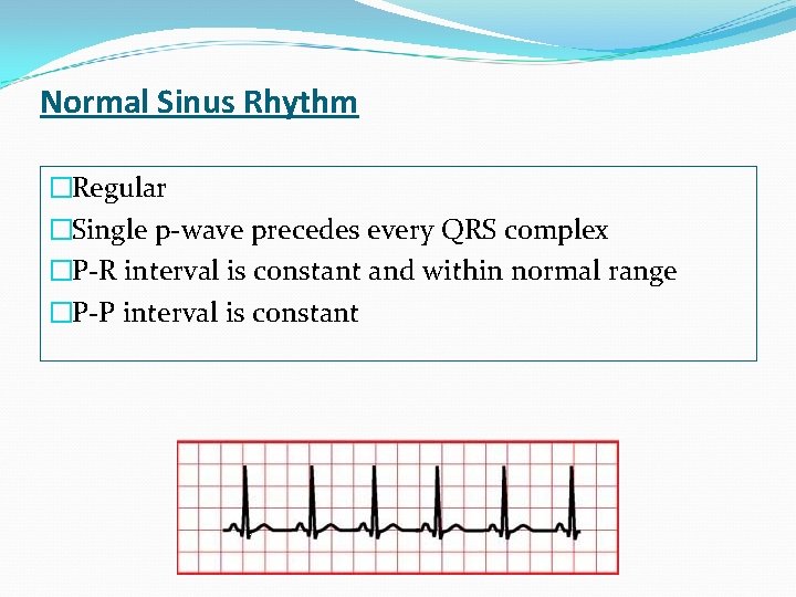 Normal Sinus Rhythm �Regular �Single p-wave precedes every QRS complex �P-R interval is constant