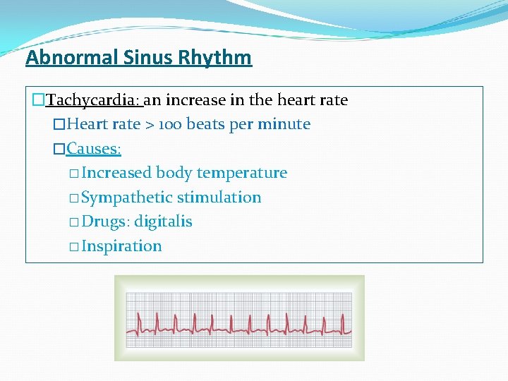 Abnormal Sinus Rhythm �Tachycardia: an increase in the heart rate �Heart rate > 100