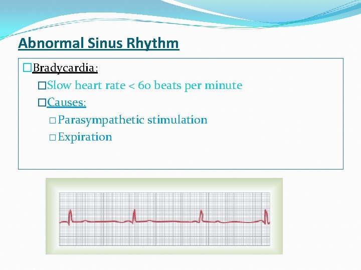 Abnormal Sinus Rhythm �Bradycardia: �Slow heart rate < 60 beats per minute �Causes: �