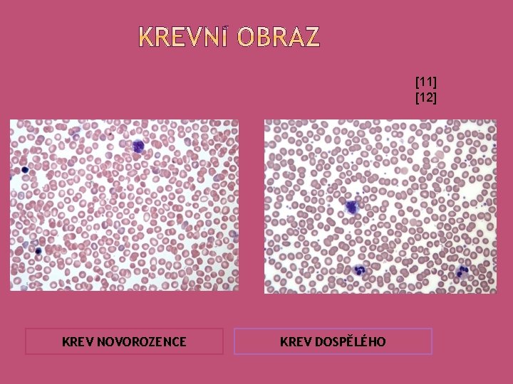 [11] [12] KREV NOVOROZENCE KREV DOSPĚLÉHO 
