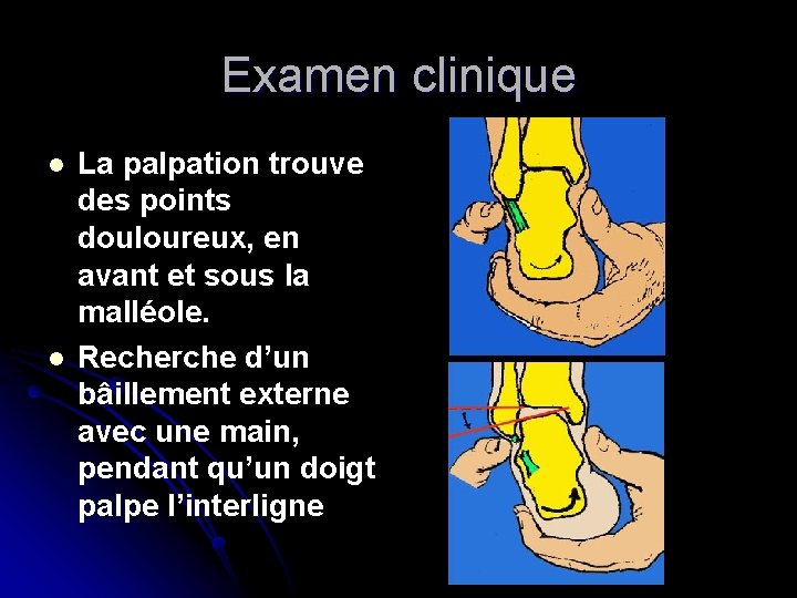 Examen clinique l l La palpation trouve des points douloureux, en avant et sous