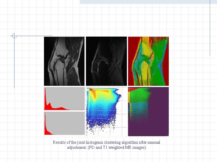 Results of the joint histogram clustering algorithm after manual adjustment. (PD and T 1