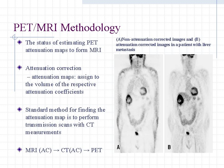 PET/MRI Methodology The status of estimating PET attenuation maps to form MRI Attenuation correction