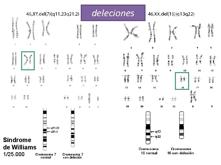 GENÉTICA LEYES DE MENDEL Biología y Geología 4º ESO deleciones Síndrome de Williams 1/25.