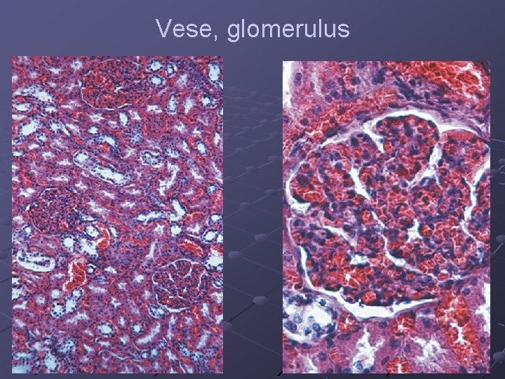 Vese, glomerulus 