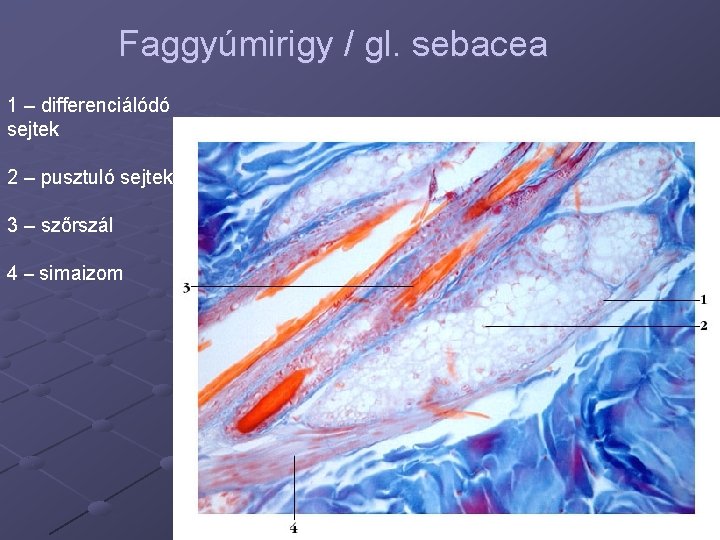 Faggyúmirigy / gl. sebacea 1 – differenciálódó sejtek 2 – pusztuló sejtek 3 –