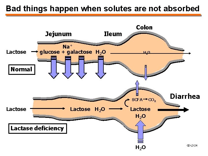 Bad things happen when solutes are not absorbed Jejunum Lactose Ileum Colon Na+ glucose