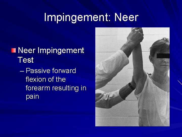 Impingement: Neer Impingement Test – Passive forward flexion of the forearm resulting in pain