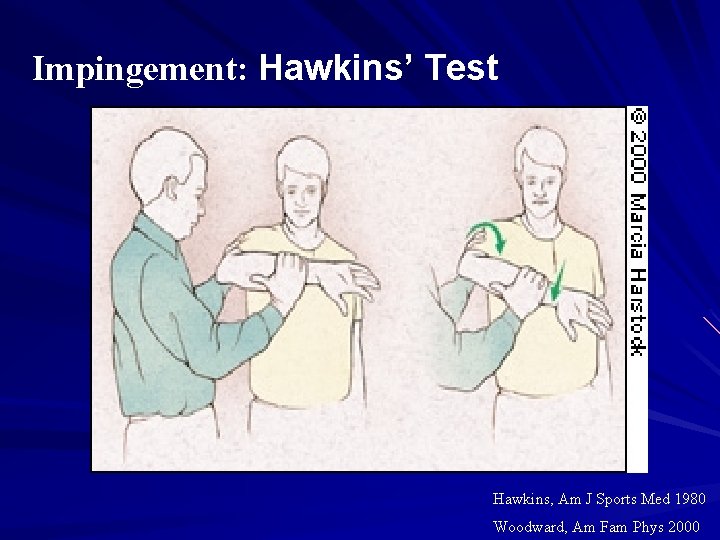 Impingement: Hawkins’ Test Hawkins, Am J Sports Med 1980 Woodward, Am Fam Phys 2000