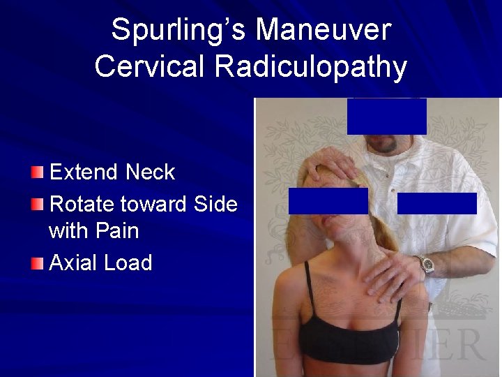 Spurling’s Maneuver Cervical Radiculopathy Extend Neck Rotate toward Side with Pain Axial Load 