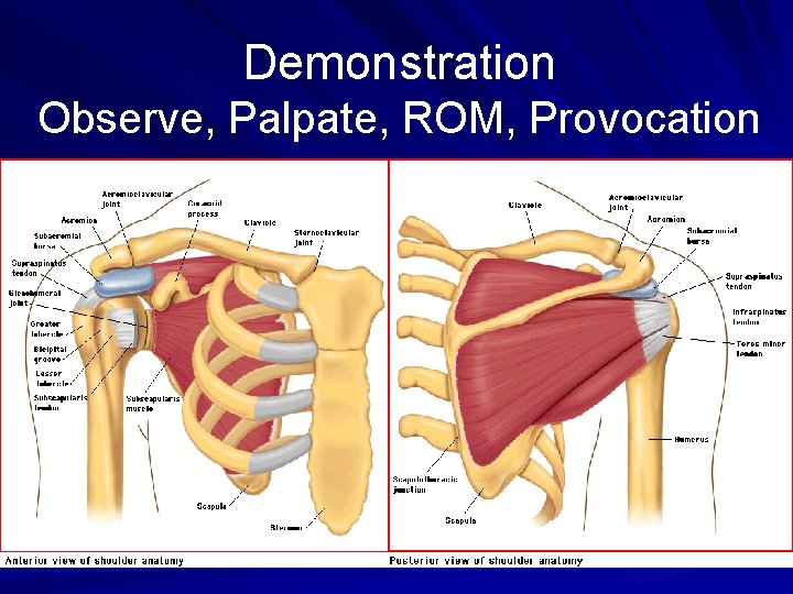 Demonstration Observe, Palpate, ROM, Provocation 