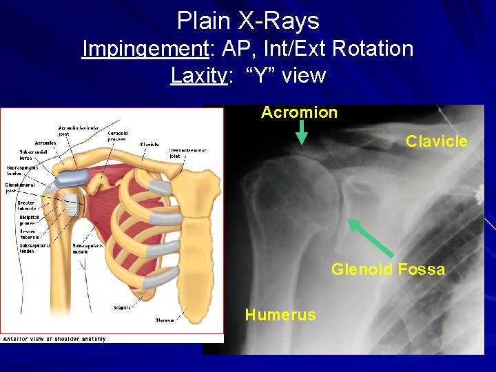 Plain X-Rays Impingement: AP, Int/Ext Rotation Laxity: “Y” view Acromion Clavicle Glenoid Fossa Humerus