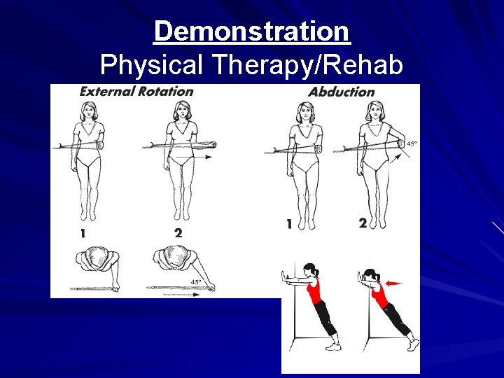 Demonstration Physical Therapy/Rehab 