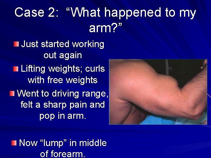 Case 2: “What happened to my arm? ” Just started working out again Lifting