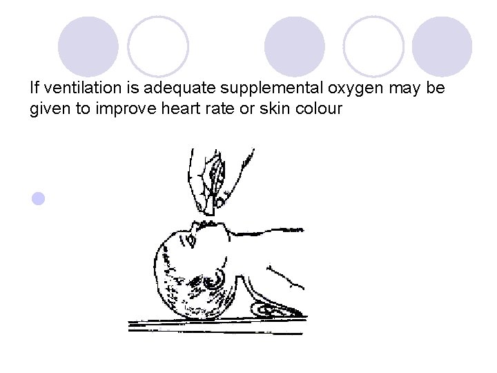 If ventilation is adequate supplemental oxygen may be given to improve heart rate or