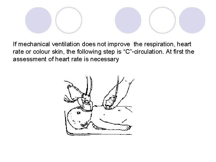 If mechanical ventilation does not improve the respiration, heart rate or colour skin, the