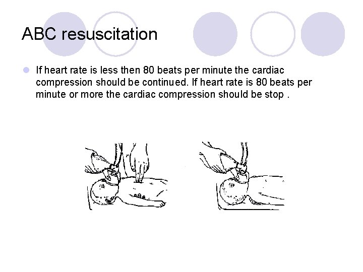 ABC resuscitation l If heart rate is less then 80 beats per minute the