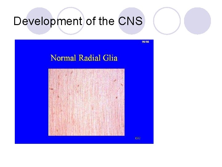 Development of the CNS 