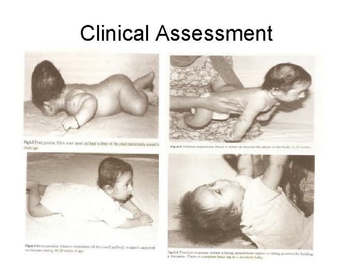 Clinical Assessment 