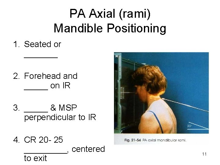 PA Axial (rami) Mandible Positioning 1. Seated or _______ 2. Forehead and _____ on