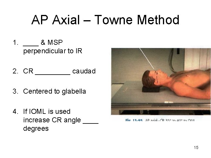 AP Axial – Towne Method 1. ____ & MSP perpendicular to IR 2. CR