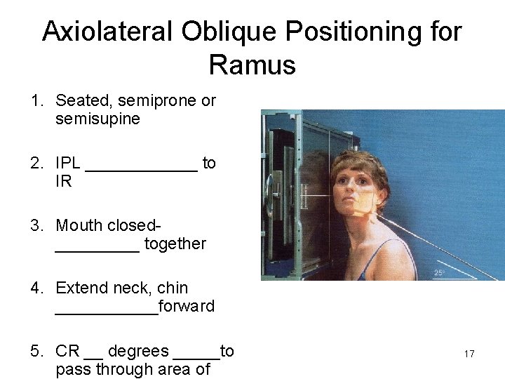 Axiolateral Oblique Positioning for Ramus 1. Seated, semiprone or semisupine 2. IPL ______ to