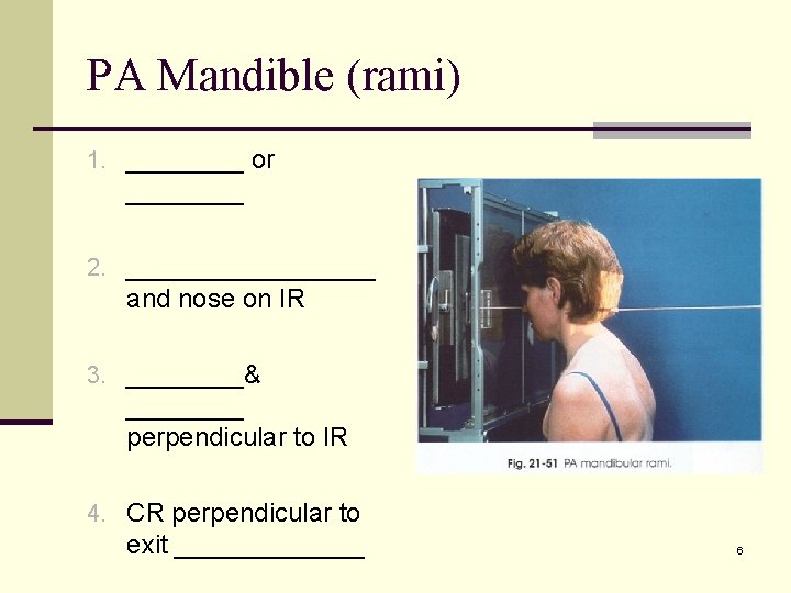 PA Mandible (rami) 1. ____ or ____ 2. _________ and nose on IR 3.