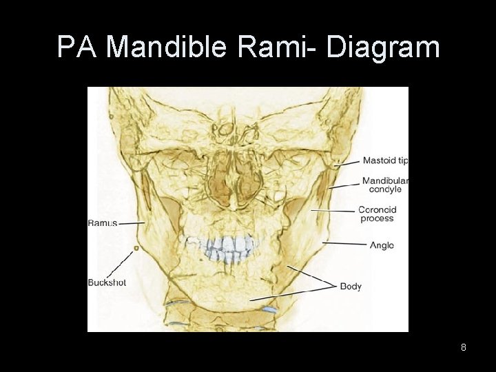 PA Mandible Rami- Diagram 8 