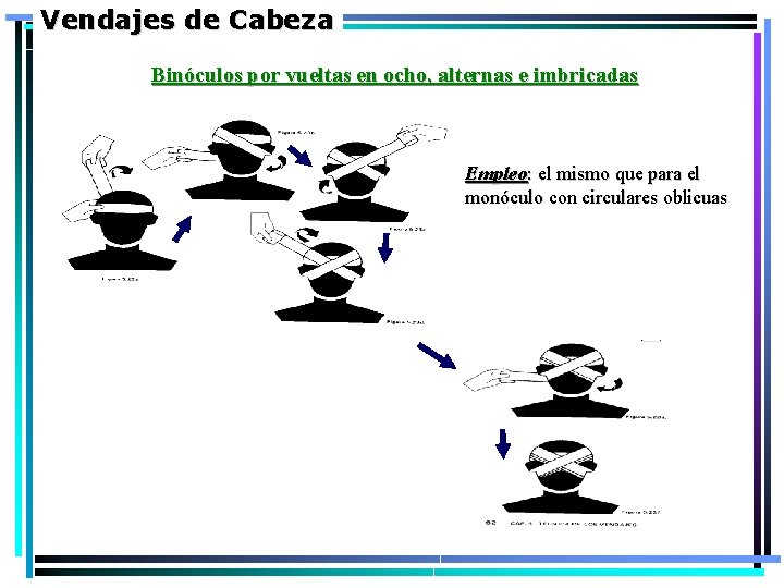 Vendajes de Cabeza Binóculos por vueltas en ocho, alternas e imbricadas Empleo: el mismo Vendajes de Cabeza Binóculos por vueltas en ocho, alternas e imbricadas Empleo: el mismo
