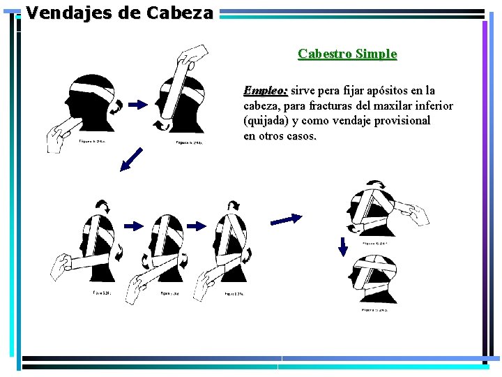 Vendajes de Cabeza Cabestro Simple Empleo: sirve pera fijar apósitos en la cabeza, para Vendajes de Cabeza Cabestro Simple Empleo: sirve pera fijar apósitos en la cabeza, para