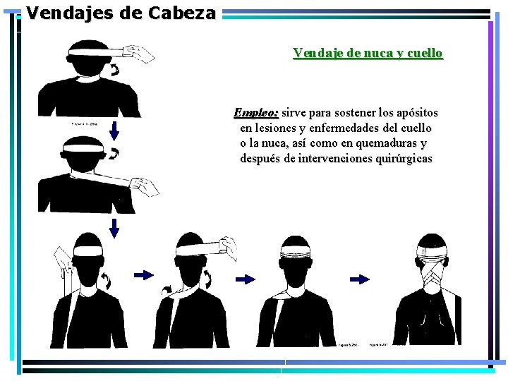 Vendajes de Cabeza Vendaje de nuca y cuello Empleo: sirve para sostener los apósitos Vendajes de Cabeza Vendaje de nuca y cuello Empleo: sirve para sostener los apósitos