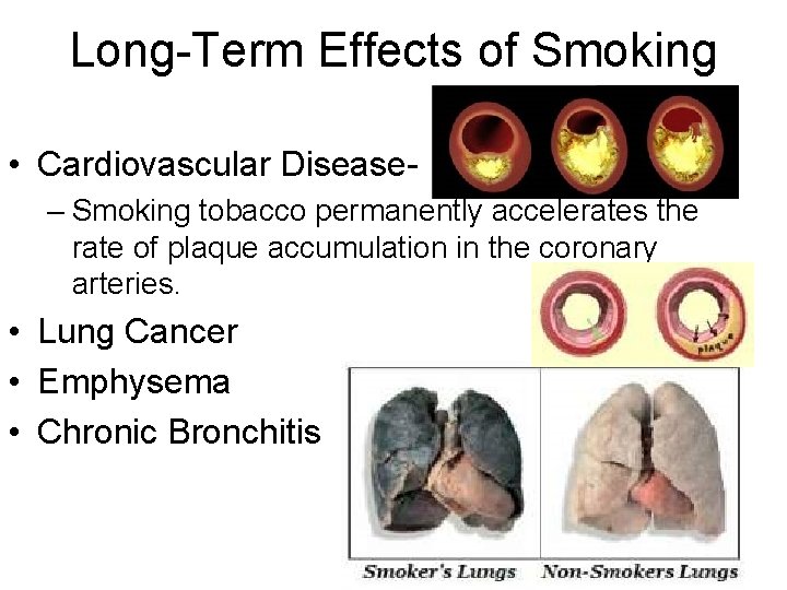 Long-Term Effects of Smoking • Cardiovascular Disease– Smoking tobacco permanently accelerates the rate of