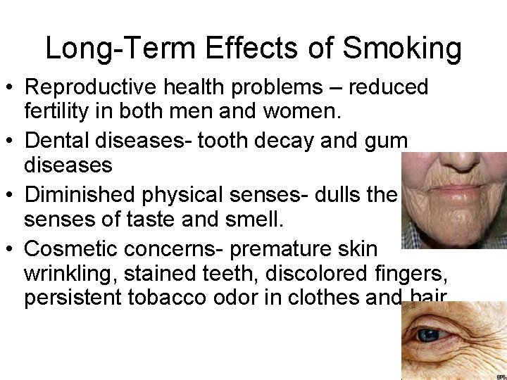 Long-Term Effects of Smoking • Reproductive health problems – reduced fertility in both men