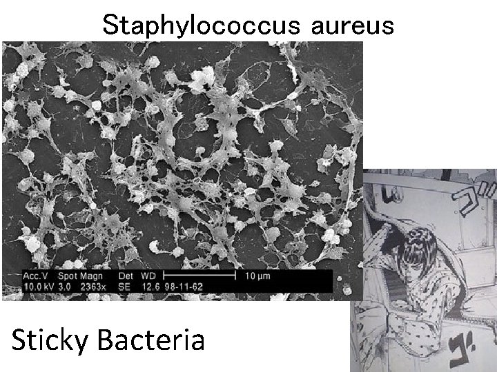 Staphylococcus aureus Sticky Bacteria 