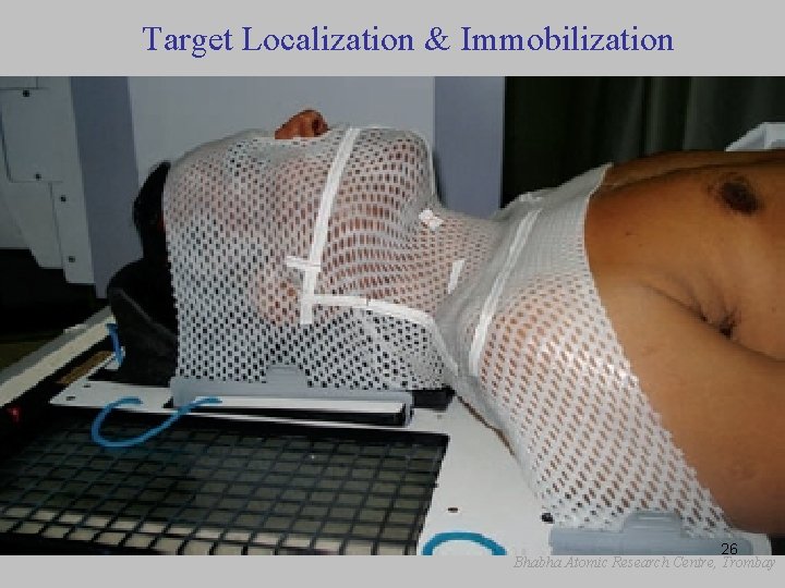 Target Localization & Immobilization 26 Bhabha Atomic Research Centre, Trombay 