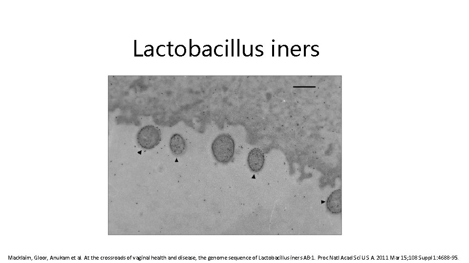 Lactobacillus iners Macklaim, Gloor, Anukam et al. At the crossroads of vaginal health and