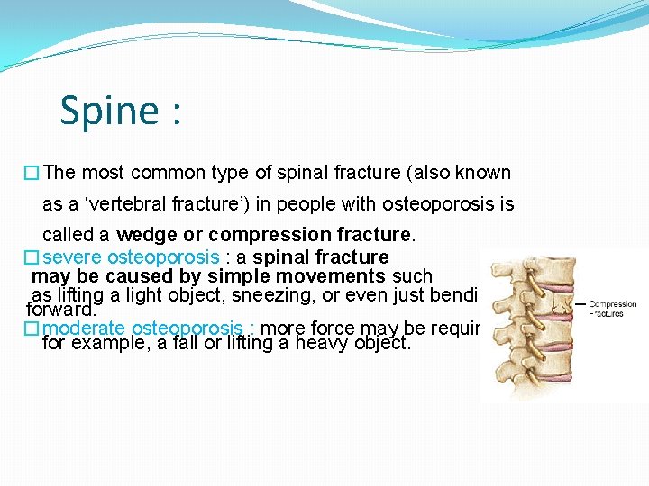 Spine : �The most common type of spinal fracture (also known as a ‘vertebral