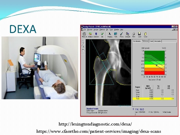 DEXA http: //lexingtondiagnostic. com/dexa/ https: //www. cfaortho. com/patient-services/imaging/dexa-scans 