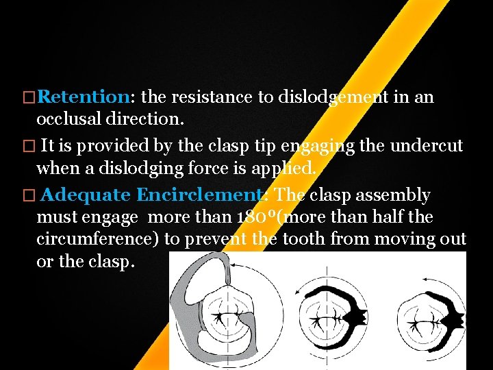 �Retention: the resistance to dislodgement in an occlusal direction. � It is provided by �Retention: the resistance to dislodgement in an occlusal direction. � It is provided by