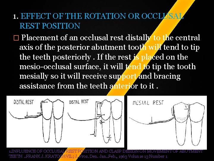 1. EFFECT OF THE ROTATION OR OCCLUSAL REST POSITION � Placement of an occlusal 1. EFFECT OF THE ROTATION OR OCCLUSAL REST POSITION � Placement of an occlusal