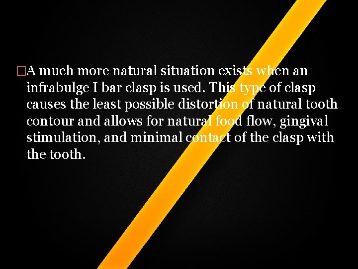 �A much more natural situation exists when an infrabulge I bar clasp is used. �A much more natural situation exists when an infrabulge I bar clasp is used.