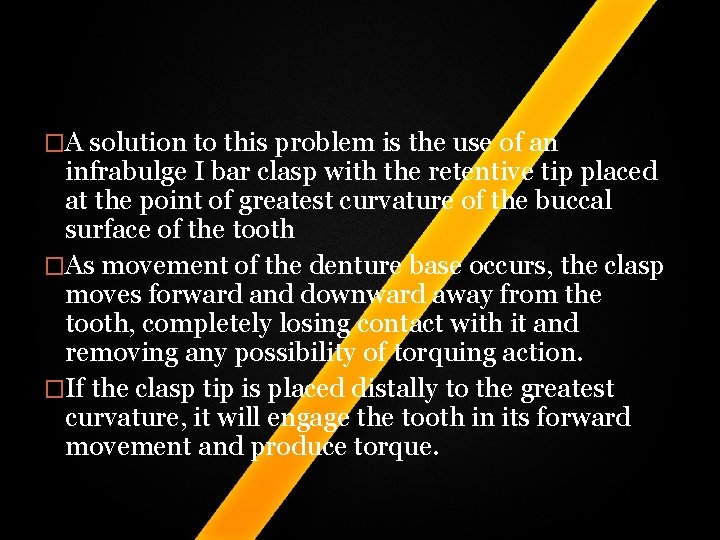 �A solution to this problem is the use of an infrabulge I bar clasp �A solution to this problem is the use of an infrabulge I bar clasp