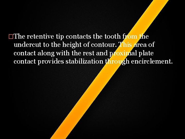 �The retentive tip contacts the tooth from the undercut to the height of contour. �The retentive tip contacts the tooth from the undercut to the height of contour.